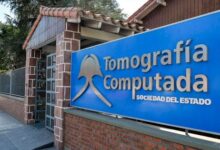 Se habilitó un nuevo resonador magnético en Tomografía del Estado