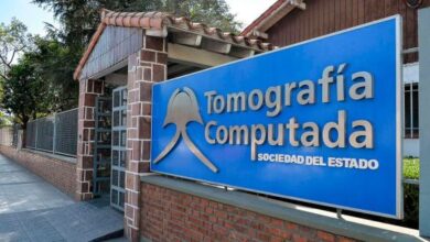 Se habilitó un nuevo resonador magnético en Tomografía del Estado