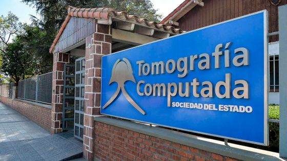 Se habilitó un nuevo resonador magnético en Tomografía del Estado