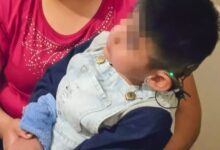 Niños detectados con hipoacusia recibirán implante coclear en forma gratuita