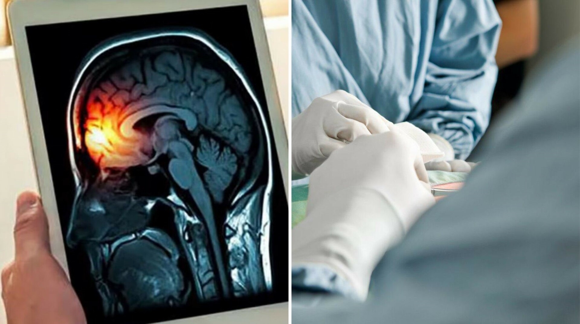 Ocho casos de meningitis en la provincia: se mantiene vigilancia ...